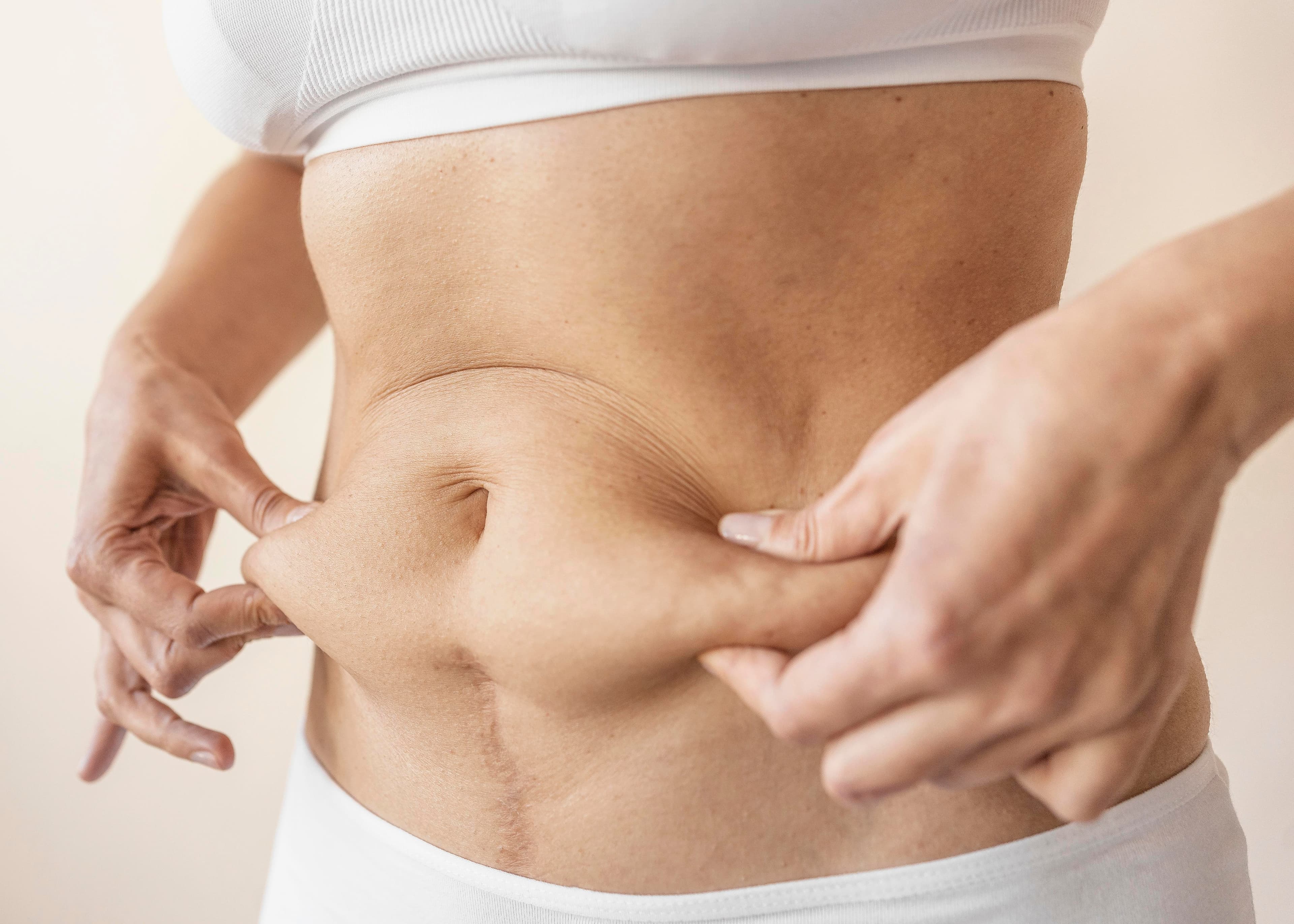 Lipocavitation anticellulite